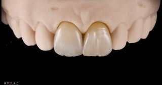 ✨ Máme radost, že se s vámi můžeme podělit o výsledky práce zubního technika Jakuba Exnera, který měl možnost vyzkoušet...